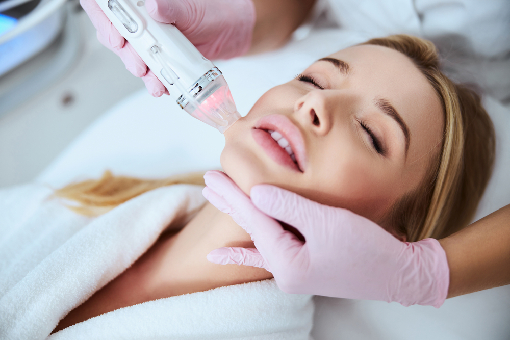 Glowing and Even Skin With RF Microneedling | New Image Cosmetic